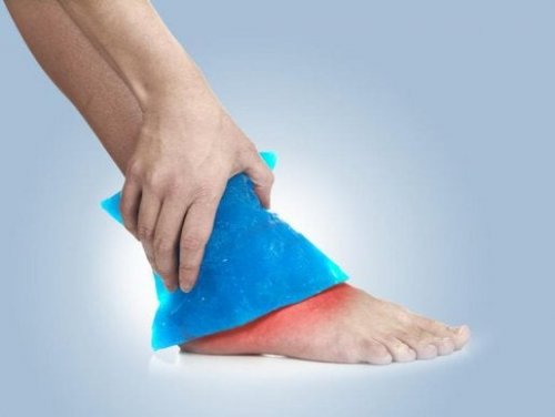 Terapia del ghiaccio
