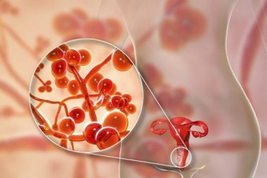 Micoplasma genitale: cause, sintomi e terapia