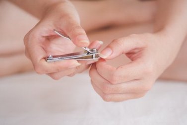 Onicocriptosi: prevenzione e trattamento