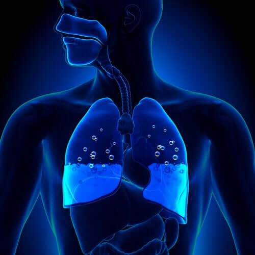 Edema polmonare: sintomi e cause