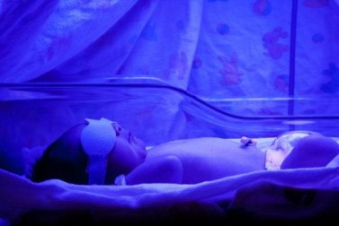 Ittero del neonato, cosa bisogna sapere?