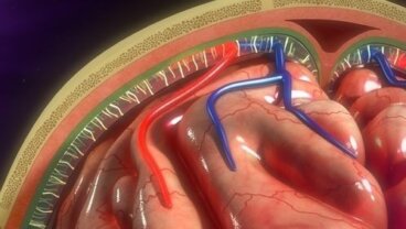 Pompa a infusione: a cosa serve e come si usa?