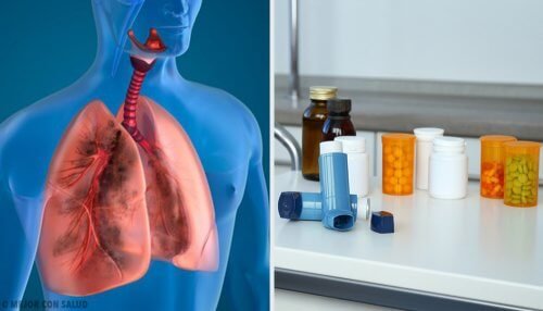 Trattamento di aerosolterapia