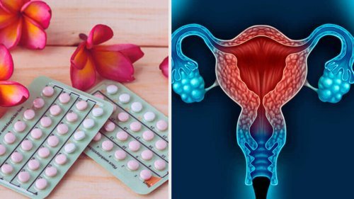 Pillole antinconcezionali.