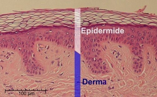 Epidermide e derma