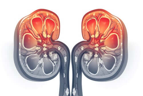 Insufficienza epatica.