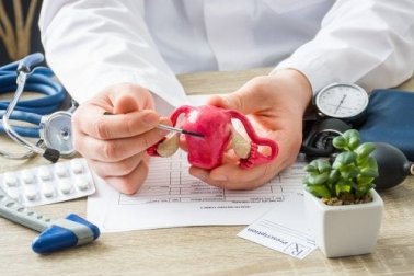 Polipi uterini: tutto quello che bisogna sapere