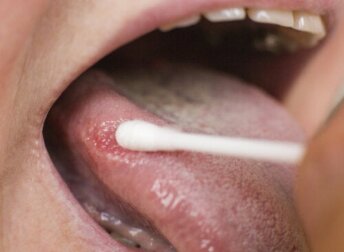 Macchie nere sulla lingua: a cosa sono dovute?