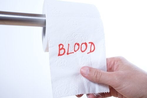 Sangue nelle feci: quali sono le cause?