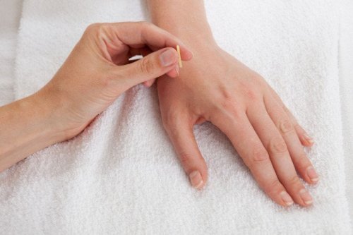 Agopuntura sulla mano