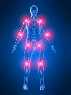 Il morbo di Paget colpisce le ossa