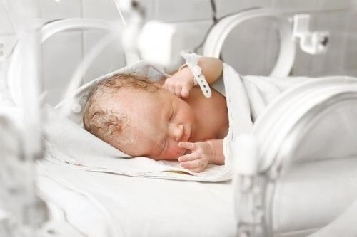 Gastroschisi: grave malformazione neonatale