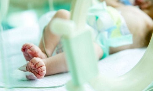 Neonato con gastroschisi
