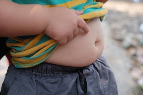 Obesità in età pediatrica bambino con grasso addominale