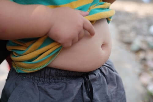 Obesità in età pediatrica: un problema rilevante