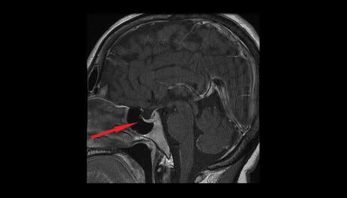 Osmolarità dei fluidi extracellulari