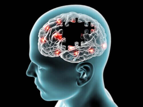 Il cervello funziona grazie al glucosio