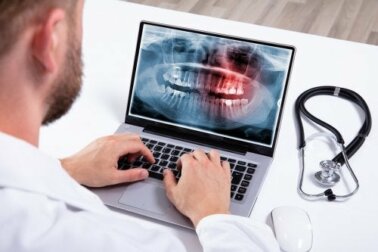 Iperodonzia: cause e opzioni di trattamento