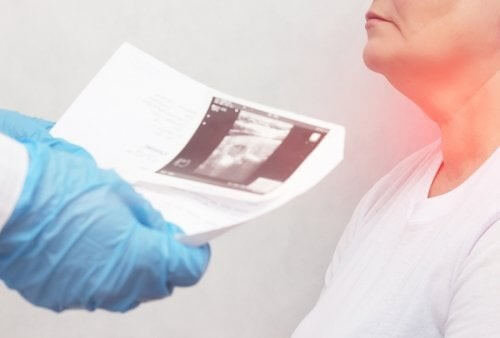 Noduli alla tiroide: sintomi e cause