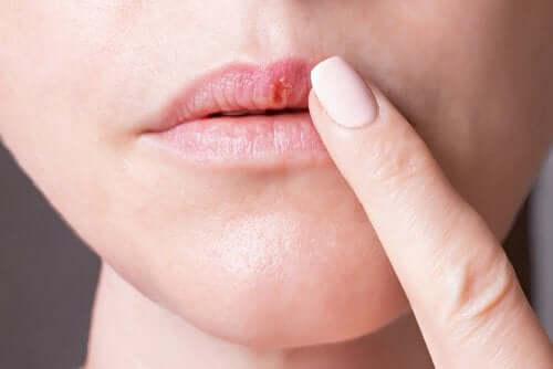 Tipi di herpes che colpiscono l'essere umano