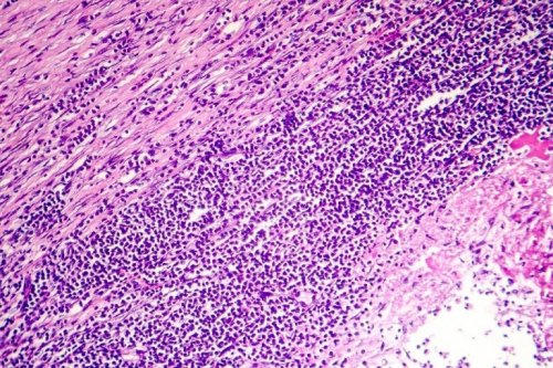 Tessuto del pericardio