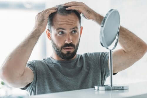 Uomo con alopecia androgenetica