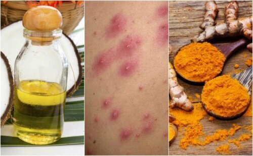 Brufoli sul cuoio capelluto rimedi