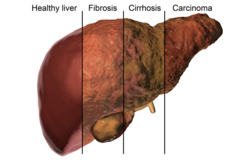Il fegato e il metabolismo epatico