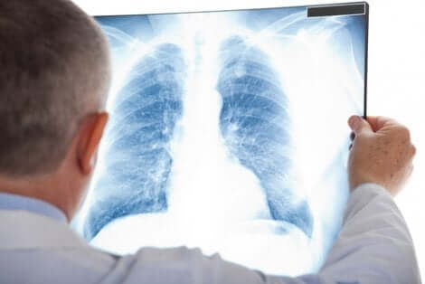 Radiografia toracica