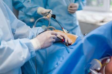 Operazione di colostomia