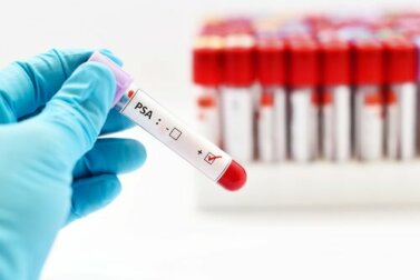 Esame della prostata: in cosa consiste?