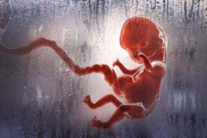 Tipi di aborto che dovreste conoscere