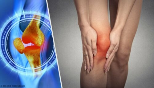 Frattura del menisco