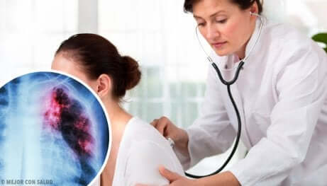 Esami diagnostici per il nodulo polmonare