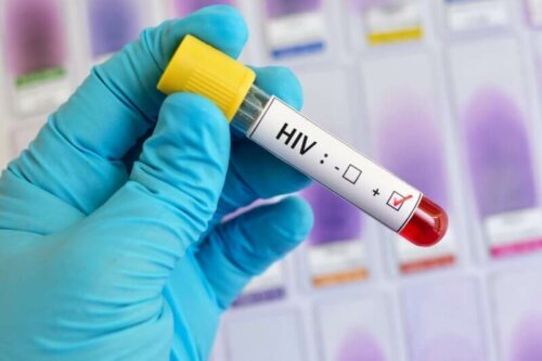Test dell'HIV.