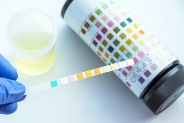Analisi delle urine: quali disturbi è possibile rilevare?