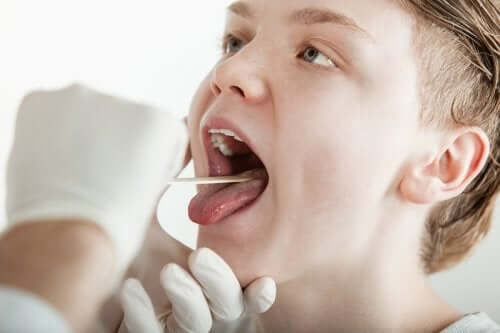 Bruciore alla bocca: cause e sintomi