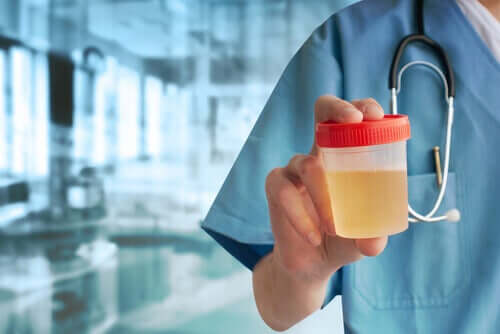 Prescrizione delle analisi delle urine
