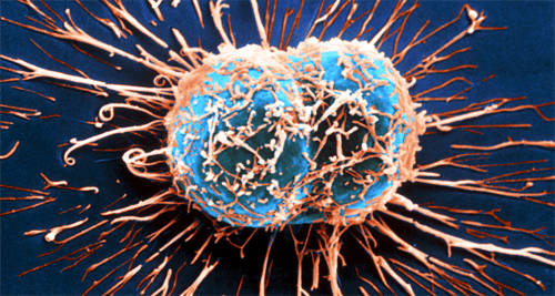 Risposta immunitaria contro il cancro: come funziona?