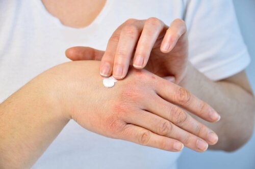 Crema per le mani screpolate
