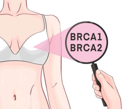 Geni BRCA1 e BRCA2, scritta e corpo femminile