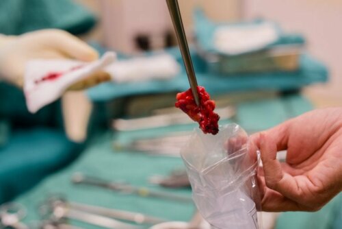 La biopsia convenzionale