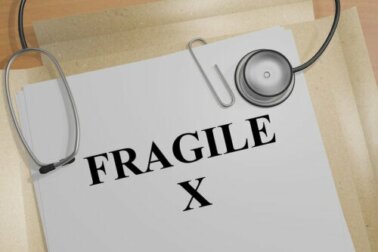 Sindrome dell'X fragile: sintomi e trattamento