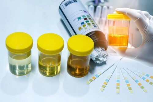 Campioni di urine da analizzare