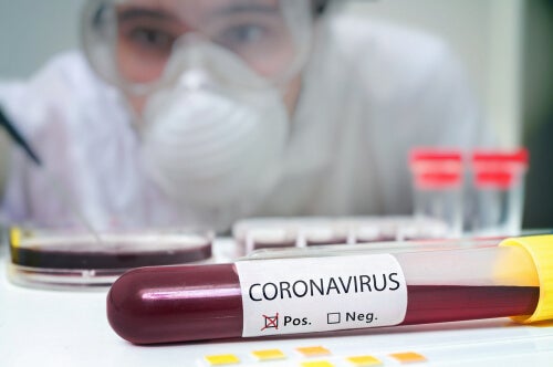 Sangue affetto da Coronavirus