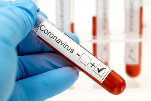 Provetta analisi del sangue per coronavirus