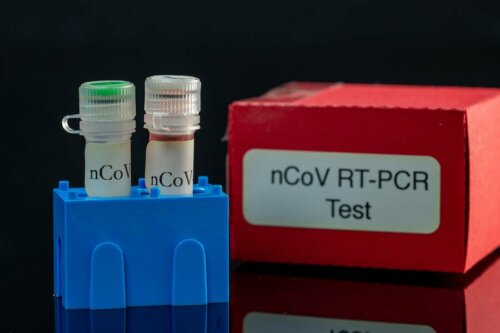 kit PCR per rilevare il Coronavirus
