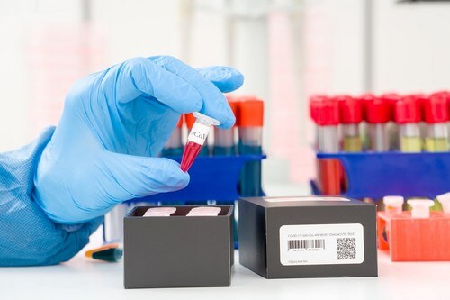 Diagnosi del Coronavirus: che cos’è la PCR?