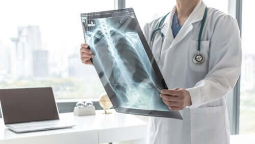 Medico esamina radiografia dei polmoni