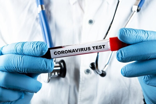 Test per rilevare il coronavirus